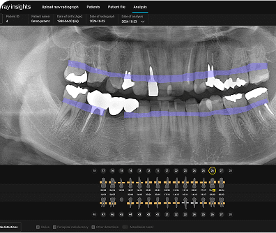 Enhanced diagnostics with detailed features.